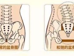 自己怎么骨盆修复