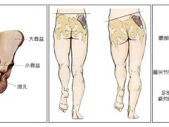 骨盆修复主要修复什么？