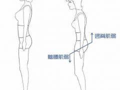 骨盆错位有什么症状