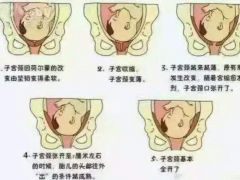 生娃以后骨盆会发生什么变化